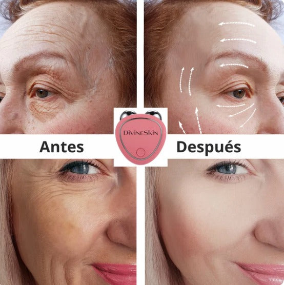 EL ORIGINAL REJUVENECIMIENTO!!! masajeador de rostro DivineSkin 🌷💁🏼‍♀️